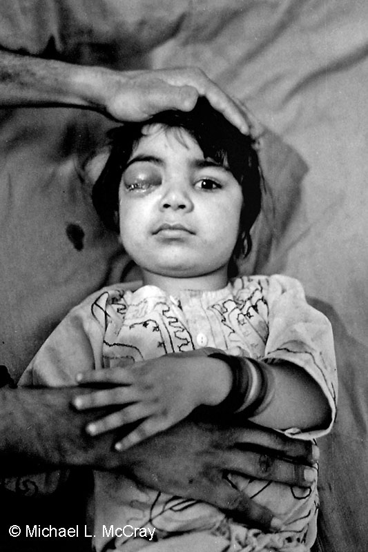 Young girl waiting for surgery